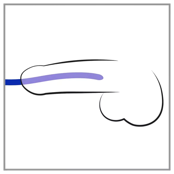 You2Toys - Silicone Dilator Set (3 Pieces)